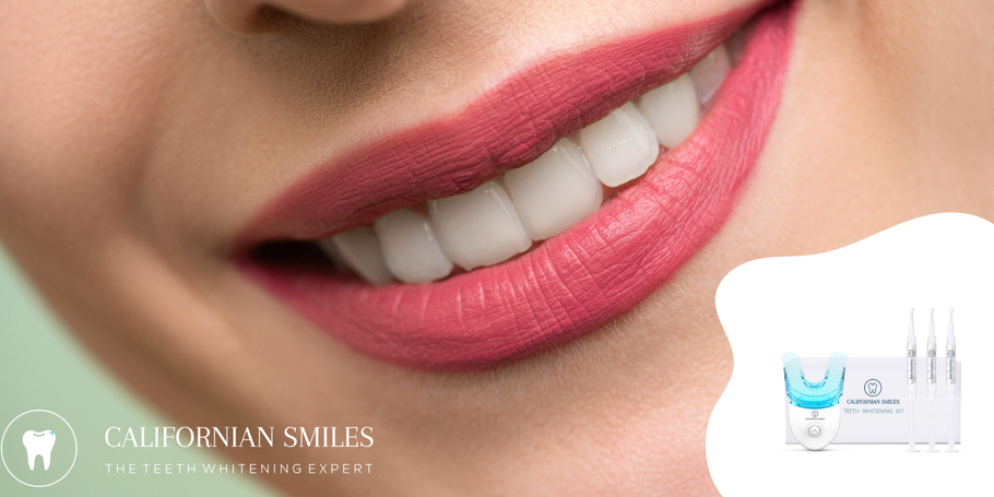 Teeth whitening before or after marriage: what you need to know.