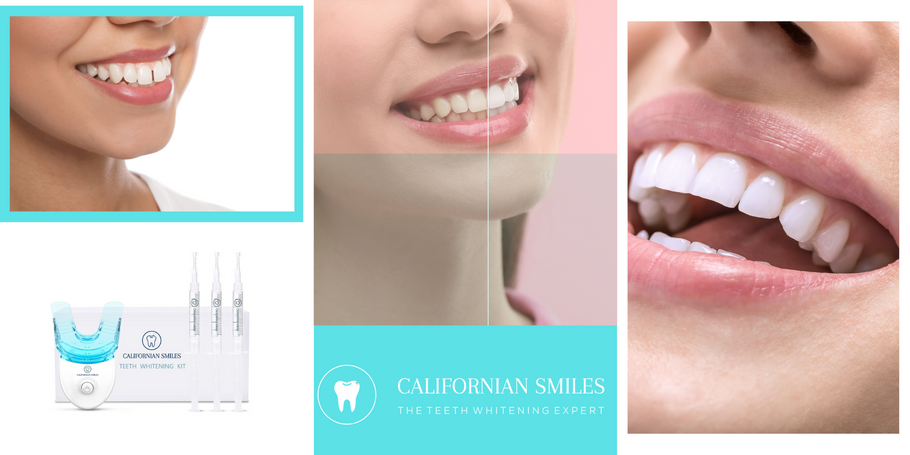 What are the criteria to take into account when choosing the best tooth whitening product?