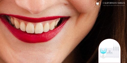 Is at-home teeth whitening safe for my teeth?