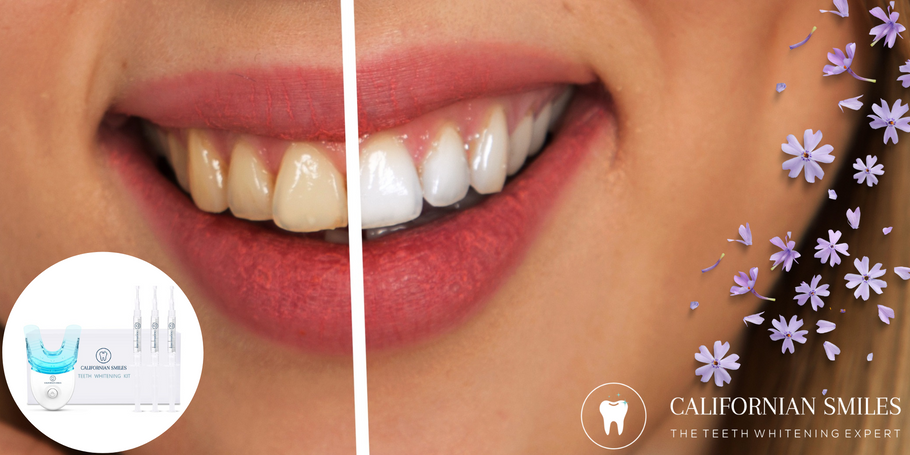 How can teeth whitening transform appearance?