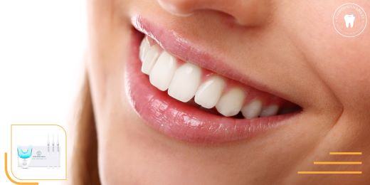 Can a teeth whitening kit remove coffee and tea stains?