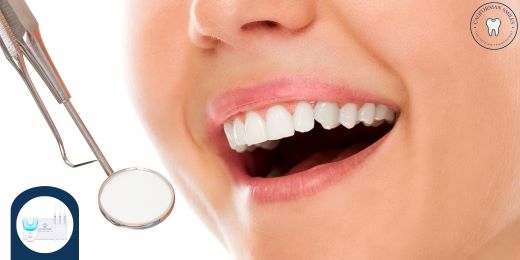 What are the steps to follow to correctly use a teeth whitening kit?